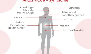 Anaphylaxie-Symptome: Schwellungen, Schnupfen, tränende Augen, Atemnot, Juckreiz, Rötungen, Schwindel, Schluck-/Sprechbeschwerden, Herzrasen, Übelkeit, Darmbeschwerden. Erste Hilfe ist wichtig!