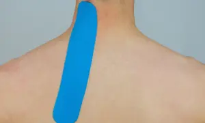 Blaues Kinesio-Tape wird am Nacken und Schulterblatt angebracht, um Unterstützung zu bieten.