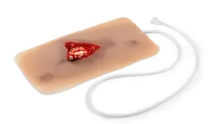 Realistisches Modell eines offenen Beinbruchs mit simuliertem Blut und Knochen.