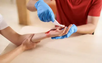 Person mit blauen Handschuhen reinigt eine blutende Wunde an der Hand, um sie zu verbinden.