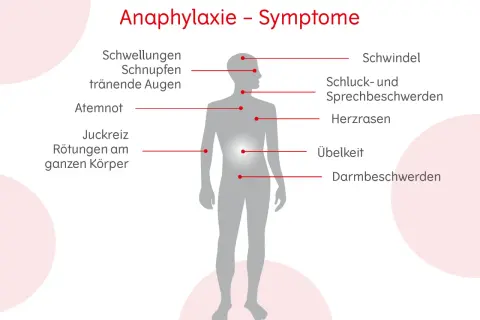 Anaphylaxie-Symptome: Schwellungen, Schnupfen, tränende Augen, Atemnot, Juckreiz, Rötungen, Schwindel, Schluck-/Sprechbeschwerden, Herzrasen, Übelkeit, Darmbeschwerden. Erste Hilfe ist wichtig!