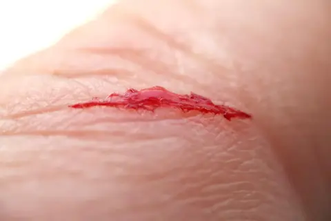 Nahaufnahme einer tiefen Schnittwunde mit Blut auf der Haut.