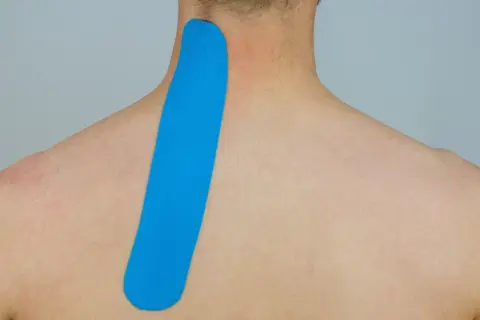 Blaues Kinesio-Tape wird am Nacken und Schulterblatt angebracht, um Unterstützung zu bieten.