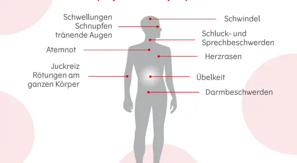 Anaphylaxie-Symptome: Schwellungen, Schnupfen, tränende Augen, Atemnot, Juckreiz, Rötungen, Schwindel, Schluck-/Sprechbeschwerden, Herzrasen, Übelkeit, Darmbeschwerden. Erste Hilfe ist wichtig!