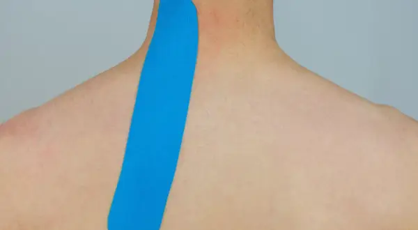 Blaues Kinesio-Tape wird am Nacken und Schulterblatt angebracht, um Unterstützung zu bieten.