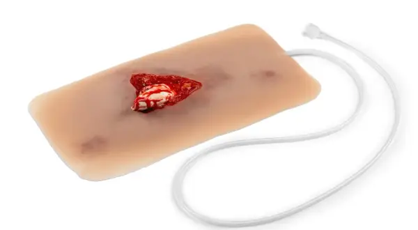 Realistisches Modell eines offenen Beinbruchs mit simuliertem Blut und Knochen.