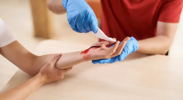 Person mit blauen Handschuhen reinigt eine blutende Wunde an der Hand, um sie zu verbinden.