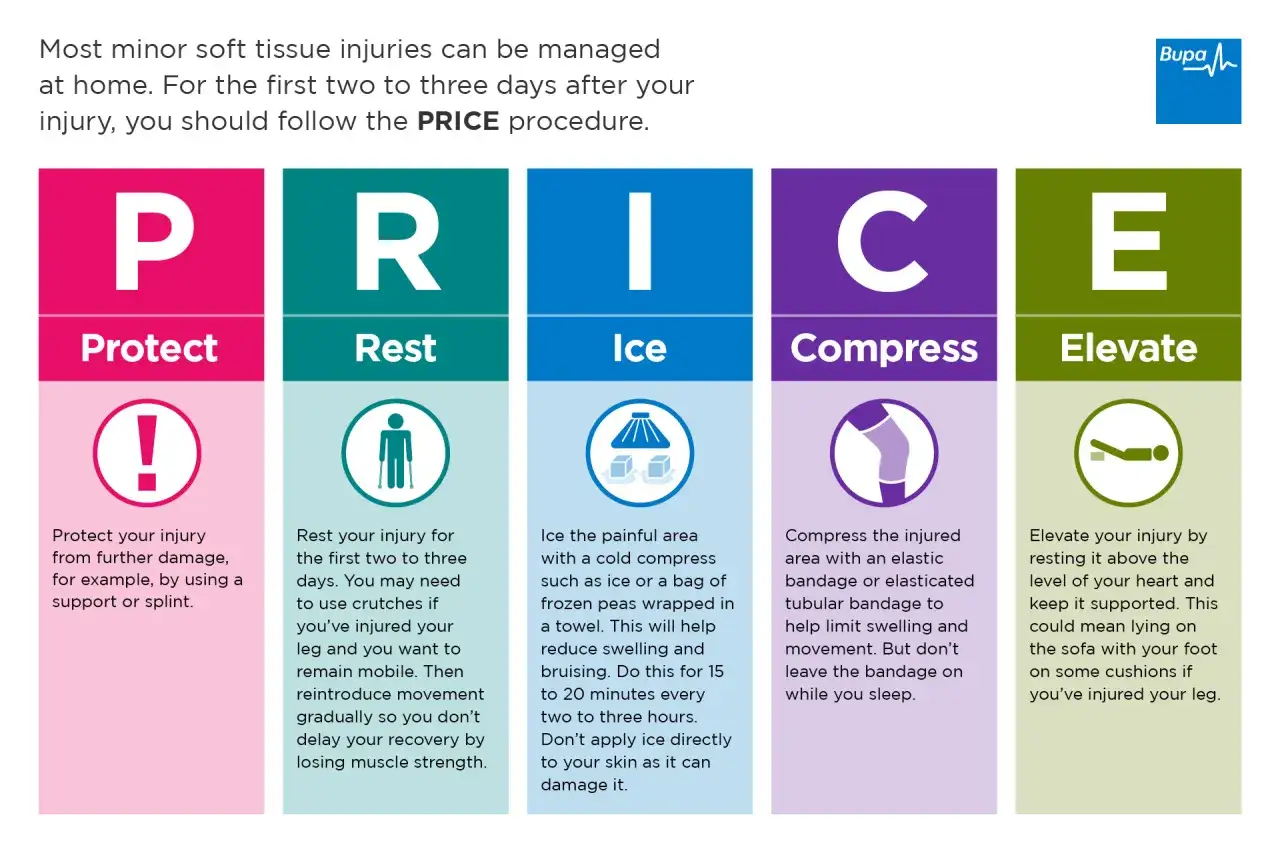 PRICE-Schema zur Behandlung von Verletzungen: Protect, Rest, Ice, Compress, Elevate. Bei einer Verletzung der Wade hilft Kompression.