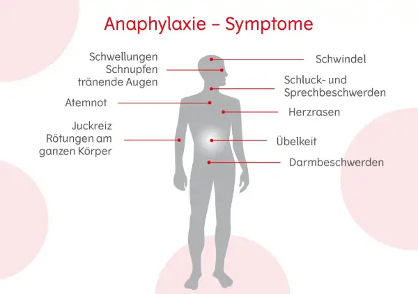 Anaphylaxie-Symptome: Schwellungen, Schnupfen, tränende Augen, Atemnot, Juckreiz, Rötungen, Schwindel, Schluck-/Sprechbeschwerden, Herzrasen, Übelkeit, Darmbeschwerden. Erste Hilfe ist wichtig!