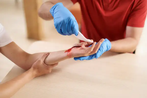 Person mit blauen Handschuhen reinigt eine blutende Wunde an der Hand, um sie zu verbinden.